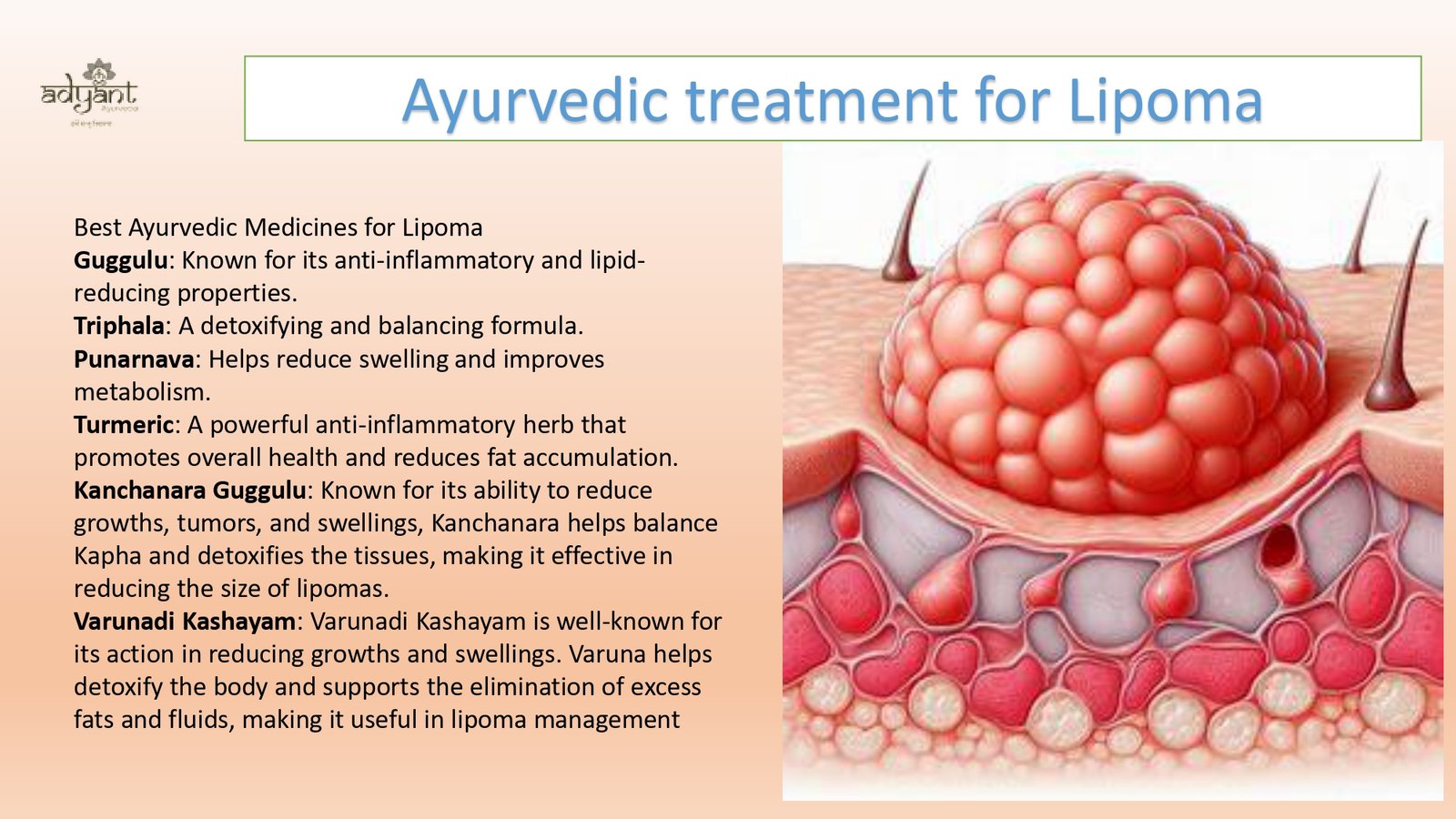 Read more about the article Ayurvedic Treatment for Lipoma