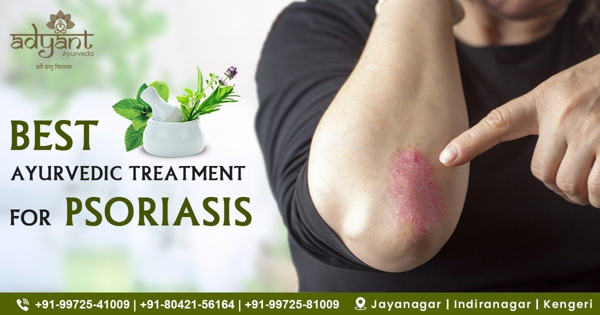 Psoriasis Treatment in Ayurveda: Symptoms, Causes & Remedies