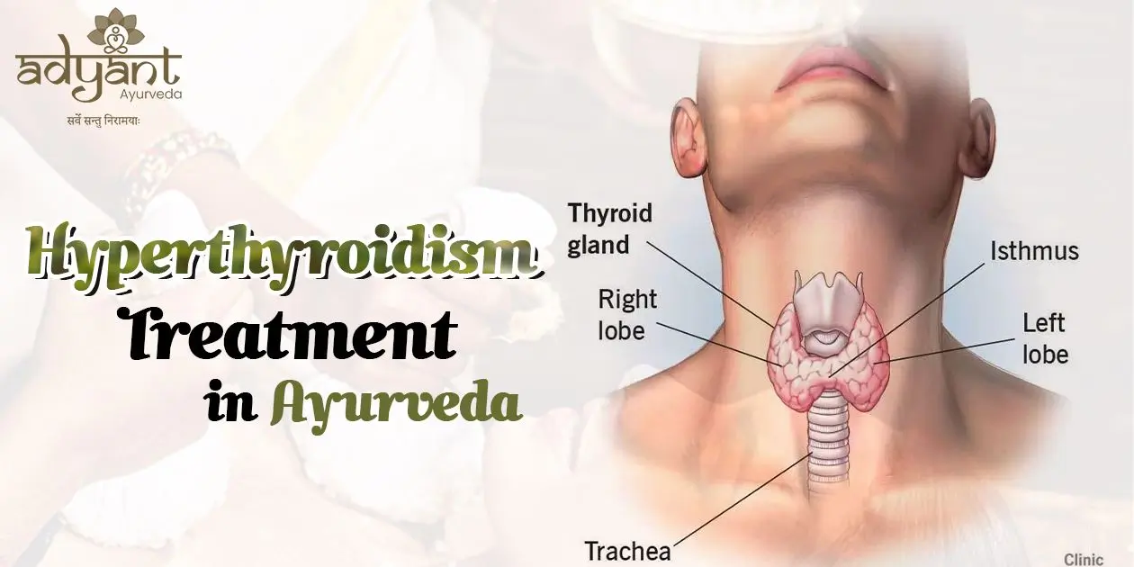 Read more about the article Ayurveda Treatment For Hyperthyroidism