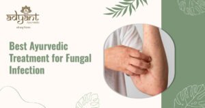 Read more about the article Best Ayurvedic Treatment for Fungal Infection: Herbs, Home Remedies, Treatments and Best Clinic