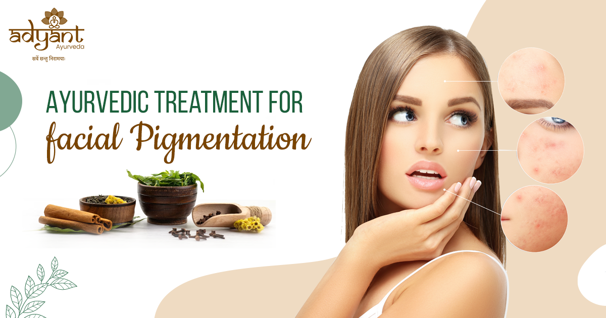 Read more about the article Ayurveda Treatment for Facial Pigmentation