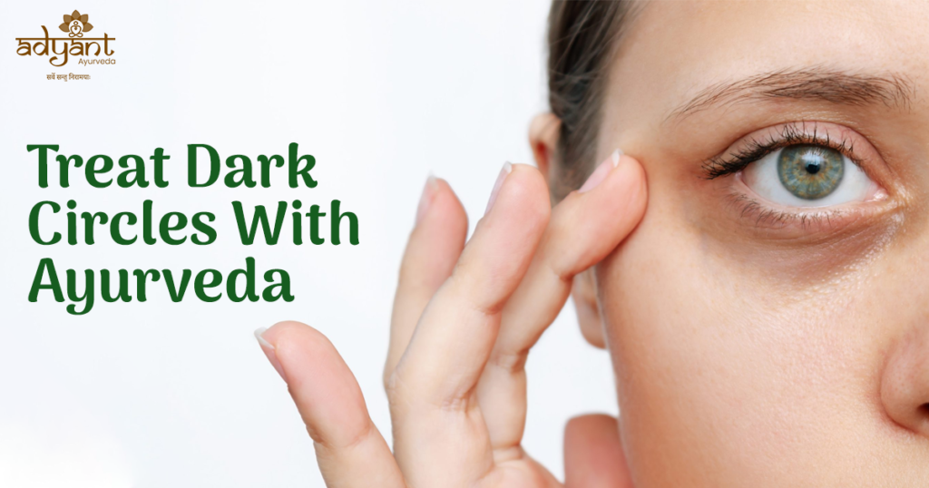 Treatment of Dark Circles With Ayurveda