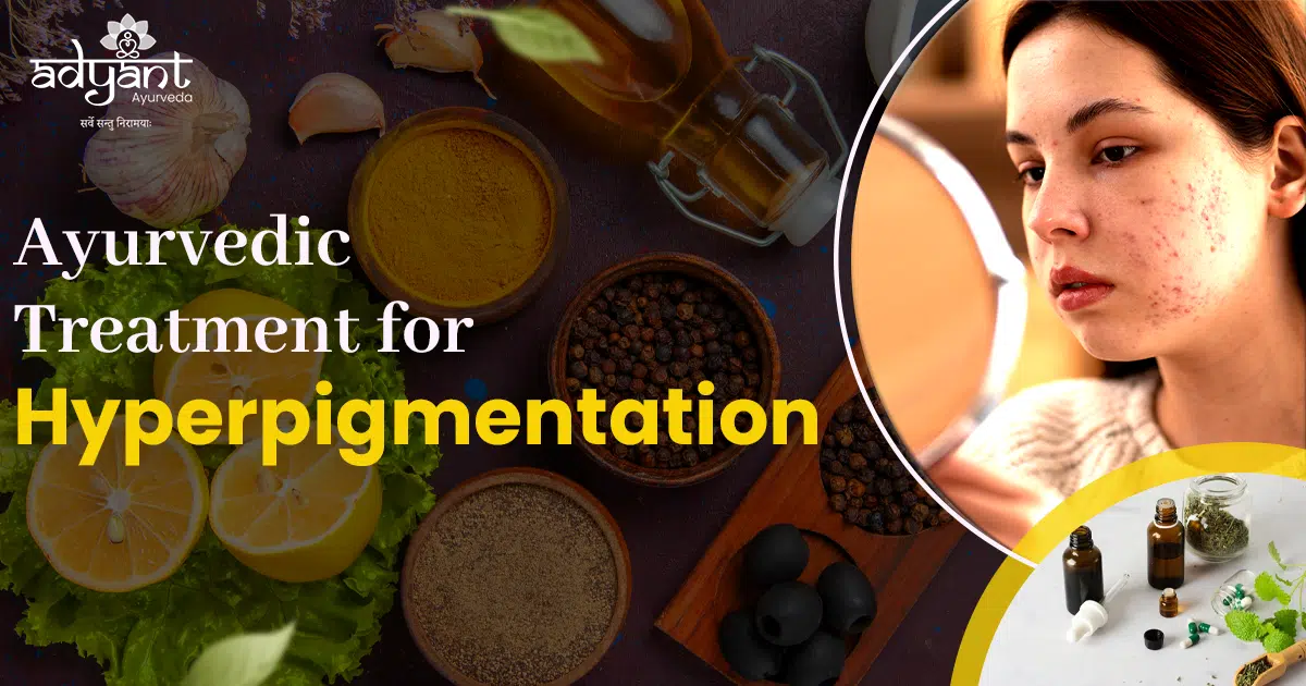 Read more about the article Ayurvedic Treatment for Hyperpigmentation: Causes, Symptoms & Remedies