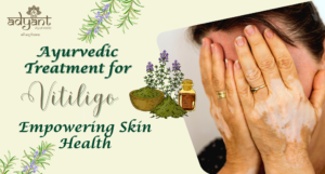 Read more about the article Ayurvedic Treatment for Vitiligo: Types, Remedies, Causes, Benefits