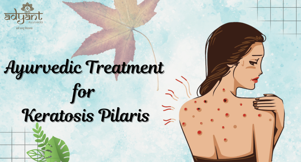 Ayurvedic Treatment for Keratosis Pilaris: Causes, Symptoms, Home Remedies, & Diagonosis