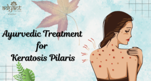 Read more about the article Ayurvedic Treatment for Keratosis Pilaris: Causes, Symptoms, Home Remedies, & Diagonosis