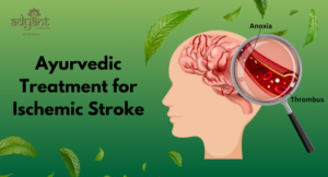 Read more about the article Ayurvedic Treatment for Ischemic Stroke