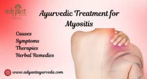 Read more about the article Ayurvedic Treatment for Myositis: Causes, Symptoms, Therapies and Remedies