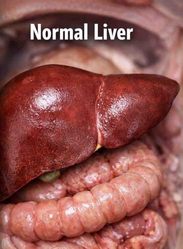 normal liver