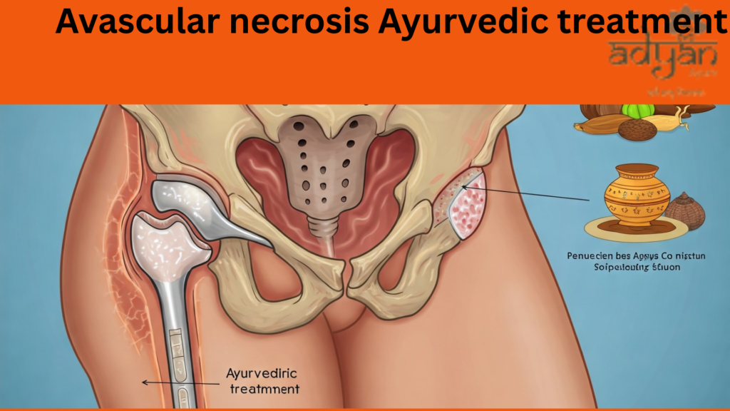 Ayurvedic Treatment for Avascular Necrosis