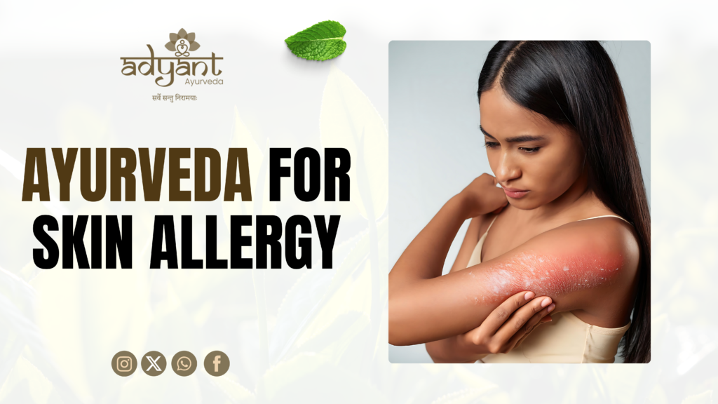 Ayurvedic treatment for skin allergy