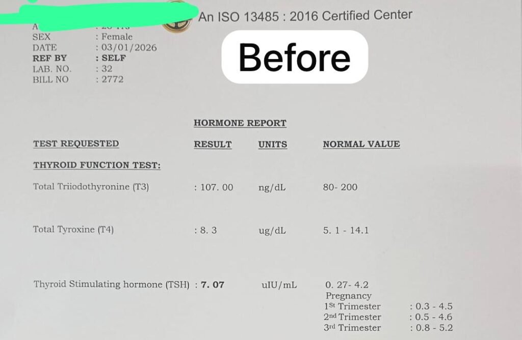 Report Before - Ayurvedic Treatment for Hypothyroid